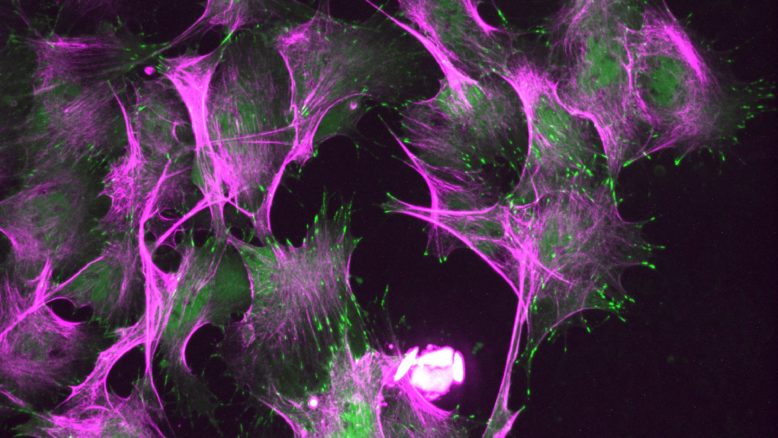 Die Vorläufer von Muskelfasern bilden Zellfäden (grün), um sich im Verband fortzubewegen; die Fasern des Zellskeletts sind violett angefärbt.